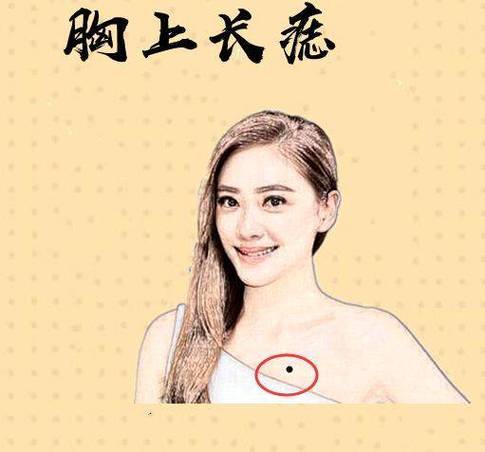 痣相学大师_面相学痣相解读_招财痣位置分析