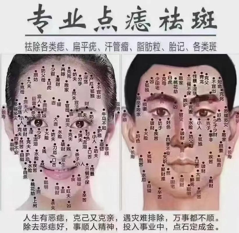 脸上痣的位置决定婚姻好坏？看夫妻宫准不准