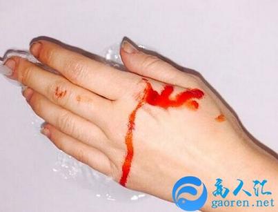 梦见手流血心理学解释_梦见手流血_梦见手流血含义